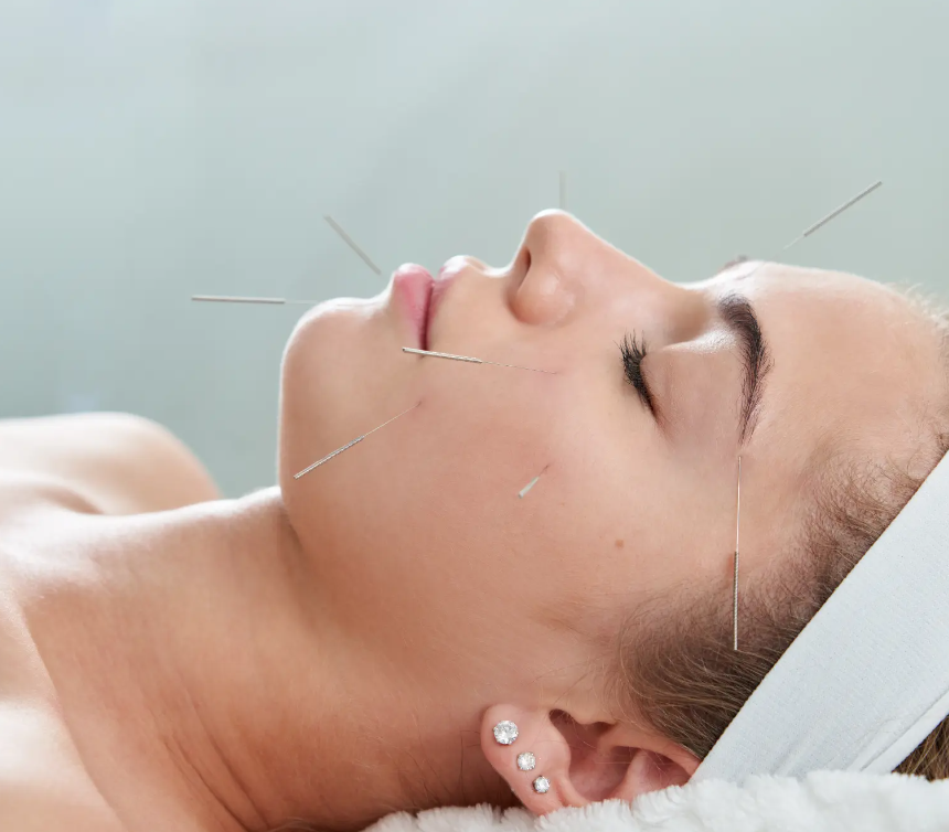 Diplomado en Acupuntura Estética