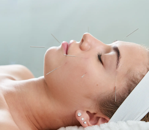 Diplomado en Acupuntura Estética
